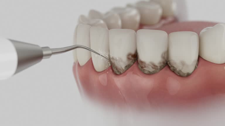 Trusted Dental Crowns And Bridges service in Topanga, CA - Dentist Open Now